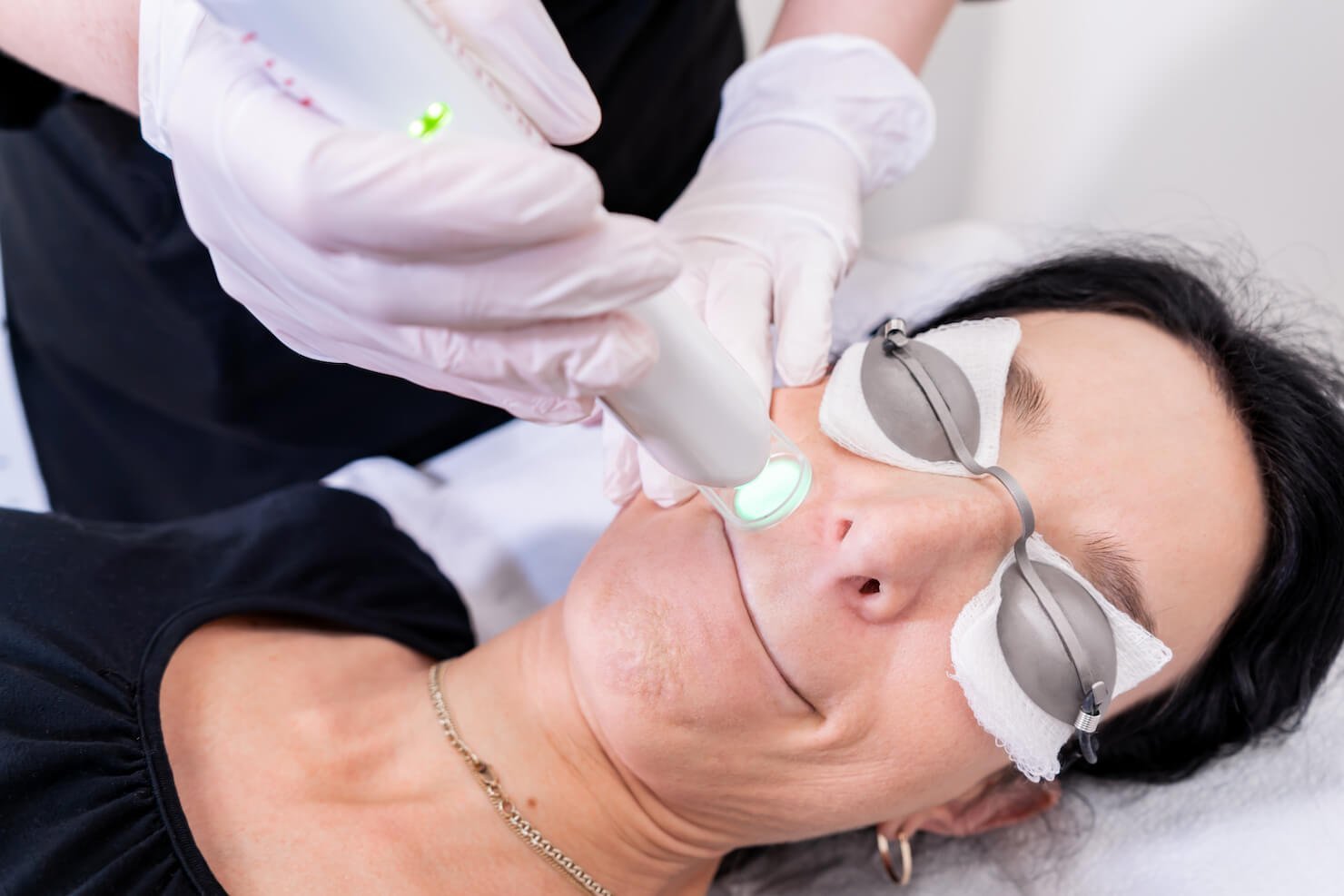 Laser Epilation at Forest Clinic