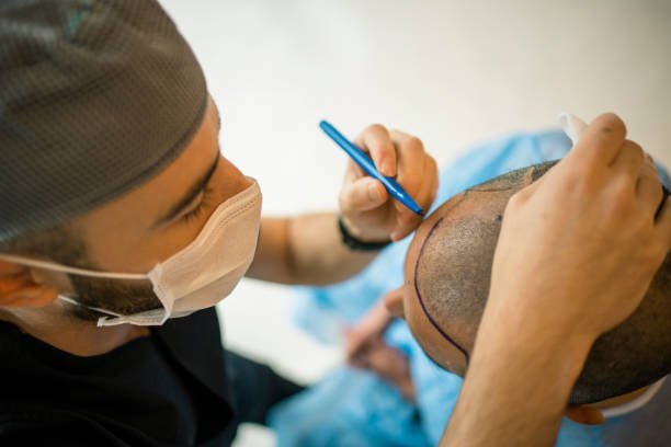 Ankara Doktor Kontrolünde Saç Ekimi